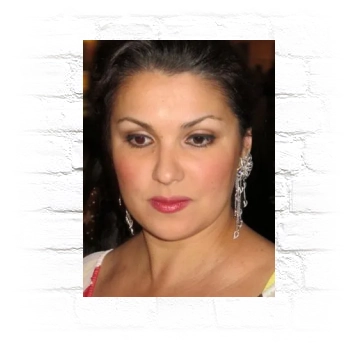 Anna Netrebko Metal Wall Art